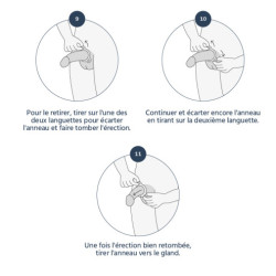 Medintim - Anneau de constriction à boucle pour Vacuum Medintim - 3
