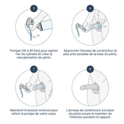Medintim - Anneau de constriction à boucle pour Vacuum Medintim - 4